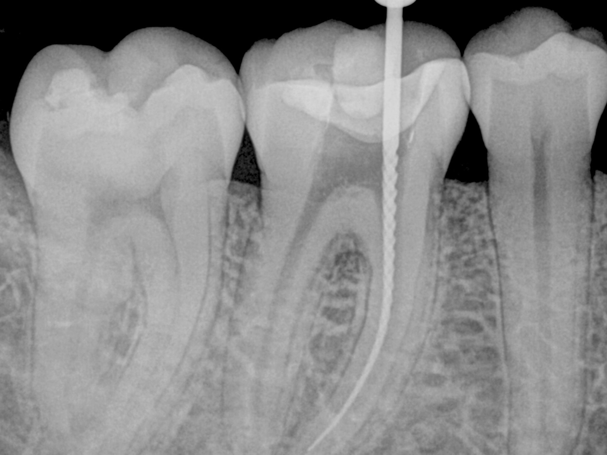 Endodonzia