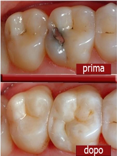 ODONTOIATRIACONSERVATIVA
