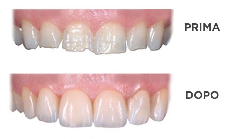 estetica dentale 2