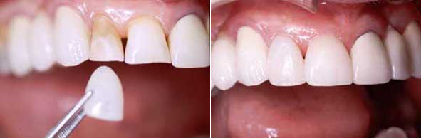 estetica dentale 3