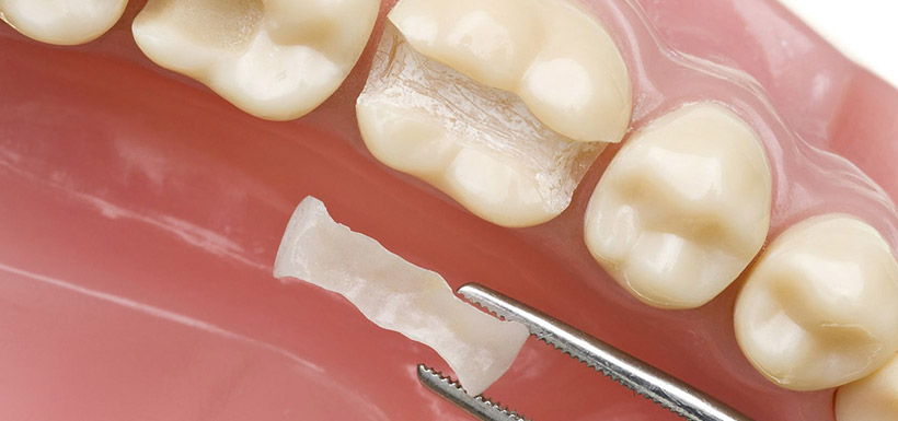 odontoiatria-conservativa-1
