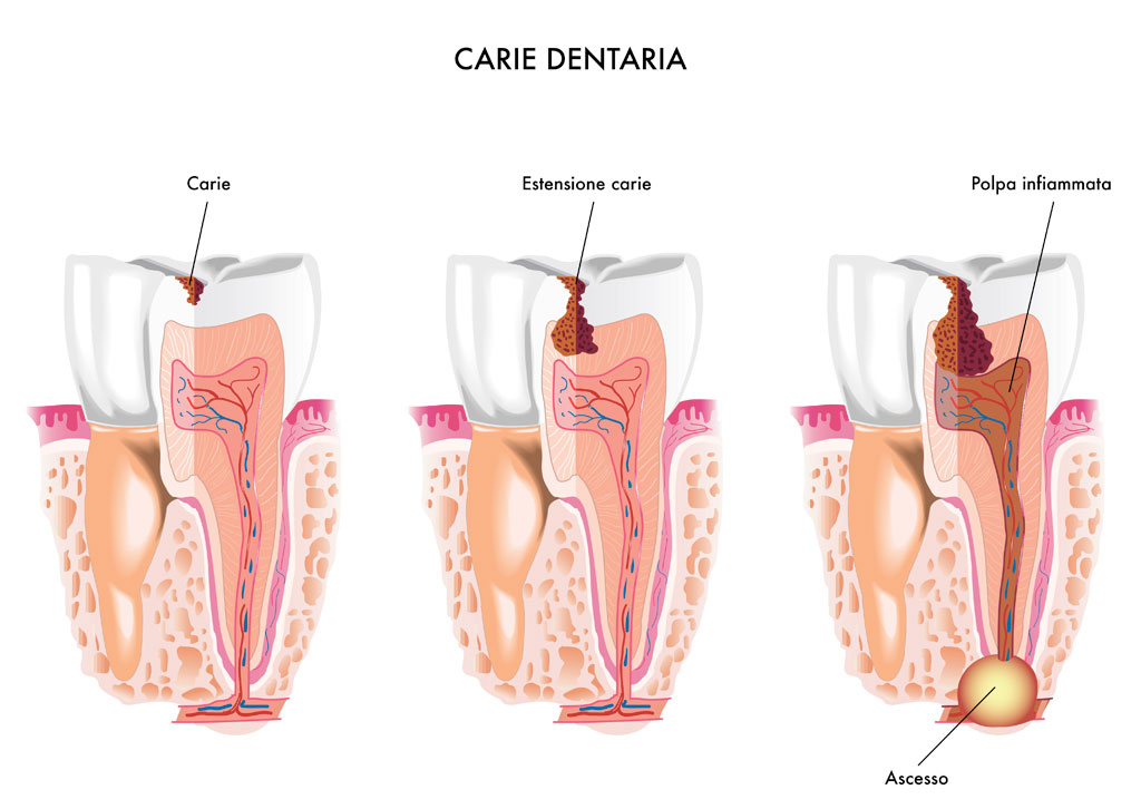 odontoiatria_conserv_01_low